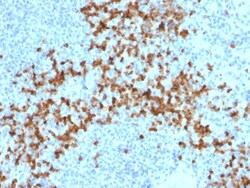Biotium&nbsp;MMP9 (Matrix Metalloproteinase 9)(2C3), CF594 conjugate, 0.1mg/mL