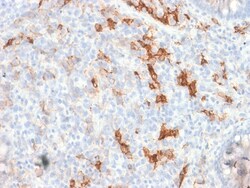 Biotium&nbsp;NGF-Receptor (p75) / CD271 (Soft Tissue Tumor Marker) (NGFR/1997R), CF640R conjugate, 0.1mg/mL