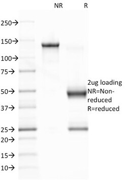 Biotium&nbsp;Epstein-Barr Virus (LMP-1)(CS1), CF405S conjugate, 0.1mg/mL