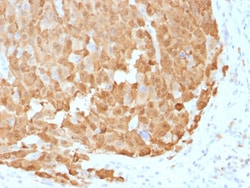 Biotium&nbsp;S100A1 (Melanoma Marker)(S100A1/1942), CF640R conjugate, 0.1mg/mL