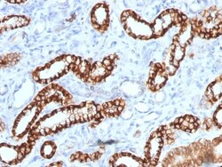 Biotium&nbsp;Ksp-Cadherin (Kidney-Specific Cadherin) / CDH16 (rCDH16/1071), CF640R conjugate, 0.1mg/mL
