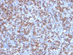 Biotium&nbsp;CD8A (Cytotoxic- & Suppressor T-Cell Marker) (C8/1779R), CF640R conjugate, 0.1mg/mL