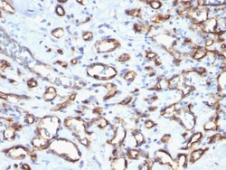 Biotium CD34 (Hematopoietic Stem Cell & Endothelial Marker)(N/A), CF640R