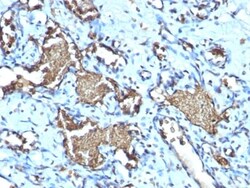 Biotium&nbsp;Glycophorin A / CD235a (Erythrocyte Marker) (GYPA/1725R), CF640R conjugate, 0.1mg/mL