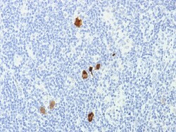 Biotium&nbsp;Epstein-Barr Virus (LMP-1)(CS1-4), CF640R conjugate, 0.1mg/mL