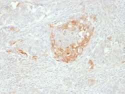 Biotium&nbsp;NSE gamma (Neuron Specific Enolase, gamma) (Neuroendocrine Marker)(NSE-P2), CF640R conjugate, 0.1mg/mL