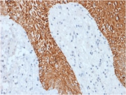 Biotium&nbsp;Cytokeratin, Multi (Epithelial Marker)(KRT/1877R), CF640R conjugate, 0.1mg/mL