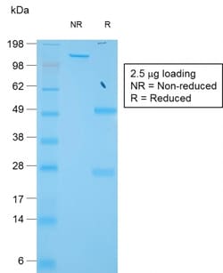 Biotium&nbsp;TIMP1 (Colorectal and Lymph Node Metastasis Marker)(TIMP1/1944R), CF405S conjugate, 0.1mg/mL