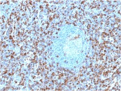 Biotium&nbsp;Annexin A1 / (Hairy Cell Leukemia Marker)(ANXA1/1671), CF640R conjugate, 0.1mg/mL