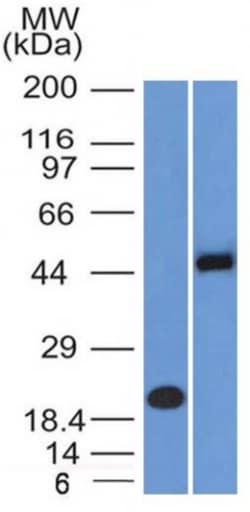 Biotium&nbsp;PAX8 (Renal Cell Marker)(PAX8/1491 + PAX8/1492), CF640R conjugate, 0.1mg/mL