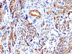 Biotium&nbsp;Caldesmon, HMW (h-Caldesmon) (Smooth Muscle Marker), CF640R conjugate, 0.1mg/mL