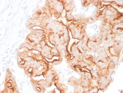 Biotium&nbsp;MUC16 / CA125 (Ovarian Carcinoma Marker)(MUC16/1860), CF640R conjugate, 0.1mg/mL