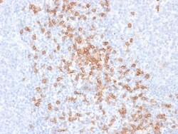 Biotium&nbsp;CD8A (Cytotoxic-&Suppressor T-Cell Marker) (rC8/468), CF640R conjugate, 0.1mg/mL