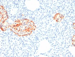 Biotium&nbsp;Chromogranin A / CHGA (Neuroendocrine Marker) (rCHGA/798), CF640R conjugate, 0.1mg/mL