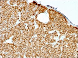 Biotium&nbsp;Parathyroid Hormone (PTH) (N-Terminal)(rPTH/911), CF640R conjugate, 0.1mg/mL