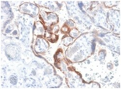 Biotium&nbsp;HCG-beta (Pregnancy & Choriocarcinoma Marker)(HCGb/1985R), CF640R conjugate, 0.1mg/mL
