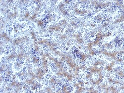 Biotium&nbsp;Glypican-3 (GPC3) (Hepatocellular Carcinoma Marker), CF640R conjugate, 0.1mg/mL