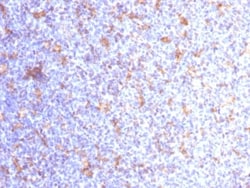 Biotium&nbsp;VEGI (Vascular Endothelial Growth Inhibitor) (VEGI/1283), CF647 conjugate, 0.1mg/mL