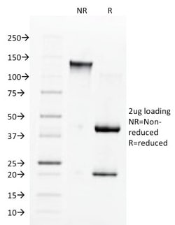 Biotium&nbsp;Angiotensin I Converting Enzyme (ACE) / CD143(9B9), CF640R conjugate, 0.1mg/mL