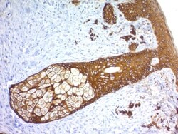 Biotium&nbsp;Cytokeratin, Basic (Type II or HMW) (Epithelial Marker) (KRTH/1576R), CF640R conjugate, 0.1mg/mL