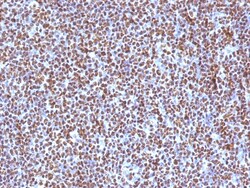 Biotium&nbsp;ALK (Anaplastic Lymphoma Kinase) / CD246(ALK/1504), CF640R conjugate, 0.1mg/mL