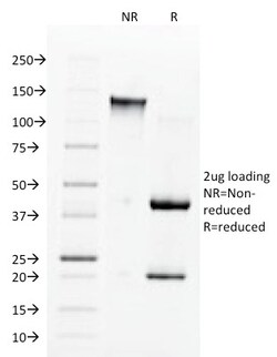 Biotium&nbsp;Angiotensin I Converting Enzyme (ACE) / CD143(9B9), CF640R conjugate, 0.1mg/mL