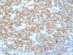 Biotium&nbsp;CD20 / MS4A1 (B-Cell Marker) (IGEL/1497R), 1mg/mL