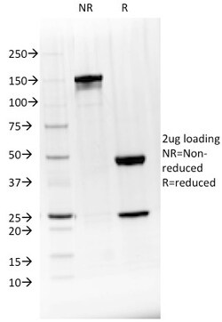 Biotium&nbsp;BTLA(BTLA/1528), CF594 conjugate, 0.1mg/mL
