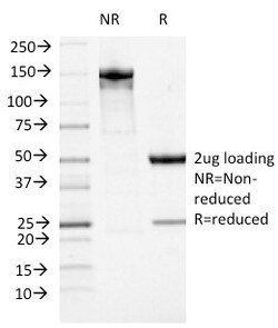 Biotium&nbsp;ATRX / RAD54 (Alpha Thalassemia Mental Retardation)(23c), CF405S conjugate, 0.1mg/mL