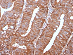 Biotium&nbsp;Calpastatin(CAST/1550), CF647 conjugate, 0.1mg/mL