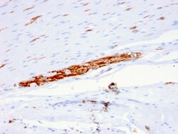 Biotium&nbsp;CD56 / NCAM1 / NKH1 (Neuronal Cell Marker)(ERIC-1), CF640R conjugate, 0.1mg/mL