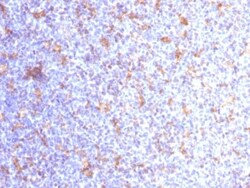 Biotium&nbsp;VEGI (Vascular Endothelial Growth Inhibitor) (VEGI/1283), CF647 conjugate, 0.1mg/mL