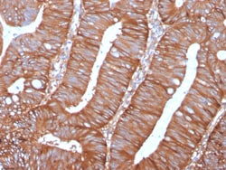 Biotium&nbsp;Calpastatin(CAST/1550), 0.2mg/mL