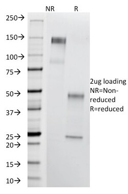 Biotium&nbsp;Thomsen-Friedenreich Antigen / CD176 (Pan Carcinoma Marker)(A84-A/F10), 0.2 mg/mL