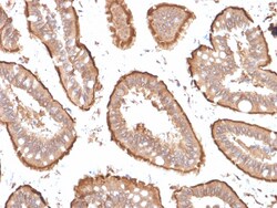 Biotium&nbsp;Villin (GI-Mucosal & Urogenital Brush Border Marker)(VIL1/1314 + VIL1/2376), CF488A conjugate, 0.1mg/mL