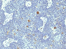 Biotium&nbsp;HPV-18 (Human Papilloma Virus 18)(HPV18/1297), CF640R conjugate, 0.1mg/mL