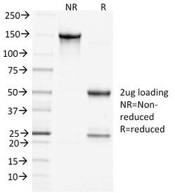 Biotium&nbsp;Clathrin, Heavy Chain(CHC/1432), CF640R conjugate, 0.1mg/mL