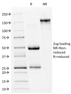 Biotium&nbsp;p53 Tumor Suppressor Protein(PAb240), CF640R conjugate, 0.1mg/mL