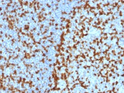 Biotium&nbsp;ZAP70 (Chronic Lymphocytic Leukemia Marker)(ZAP70/2047), CF647 conjugate, 0.1mg/mL