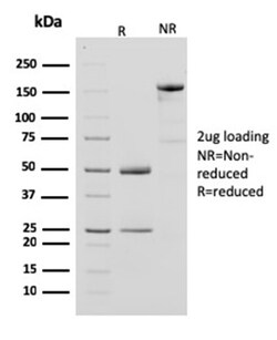 Biotium&nbsp;Creatine Phosphokinase-BB (CK-BB)(CPTC-CKB-2), CF568 conjugate, 0.1mg/mL