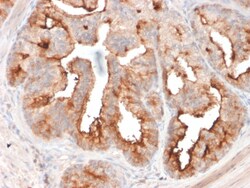 Biotium&nbsp;FOLH1 / PSMA (Prostate Epithelial Marker)(FOLH1/2354), CF640R conjugate, 0.1mg/mL