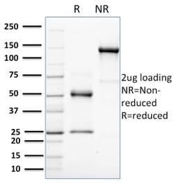 Biotium&nbsp;HER-4 / ERBB4(HFR-1), CF640R conjugate, 0.1mg/mL