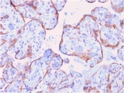 Biotium&nbsp;MMP3 (Marker of Metastasis and Rheumatoid Arthritis)(rMMP3/1730), CF640R conjugate, 0.1mg/mL
