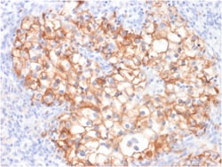 Biotium&nbsp;Ksp-Cadherin / CDH16 (Renal Cell Marker)(CDH16/2125), CF594 conjugate, 0.1mg/mL