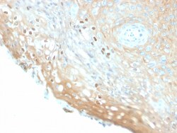 Biotium&nbsp;HPV-16 (Human Papilloma Virus 16)(HPV16/2058R), CF594 conjugate, 0.1mg/mL