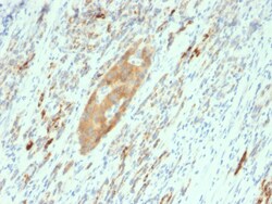 Biotium&nbsp;GAD2 / GAD65 (GABAergic Neuronal Marker)(GAD2/2362), 0.2mg/mL