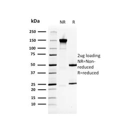 Biotium&nbsp;Heat Shock 27kDa Protein 1 (HPS27)(CPTC-HSPB1-2), 0.2mg/mL