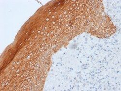 Biotium&nbsp;Cytokeratin 5/6/18(LP34), 0.2mg/mL