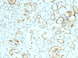 Biotium&nbsp;STAT6 (Solitary Fibrous Tumor Marker)(STAT6/2410), 1mg/mL