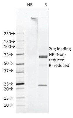 Biotium&nbsp;FAT1 (FAT atypical cadherin 1)(FAT1-3D7/1), 1mg/mL